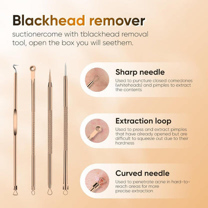 Rechargeable Pore Vacuum - 6-in-1 Blackhead Remover with Smart Display and Extraction Kit