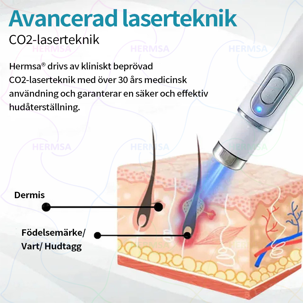 Hermsa® Non-Invasive Laser Pen - Mole and Wart Removal (🔥Last Day 80% OFF)