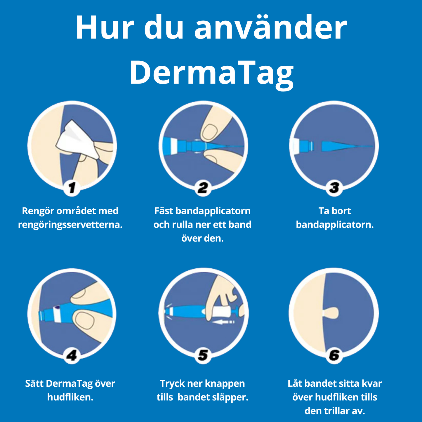 Kivuton Syylänpoistolaite