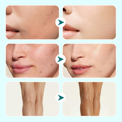 ✨Hot Sale 40% Off🥰 Kosteuttava Concealer vedenpitävä kerma naisille